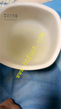 zbw0vix5fet.jpg