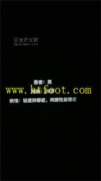 lsr2lps3a1g.jpg