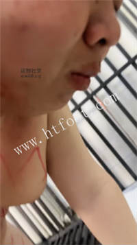 002609zxyitxymy5yelmzd.jpg