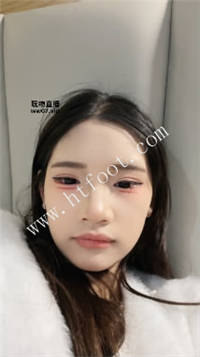 035128sa7ktaykmc7nupck.jpg
