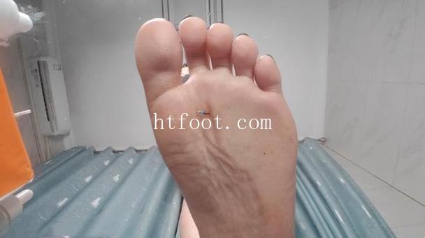 120107er8fxa0pryygp8rm.jpg