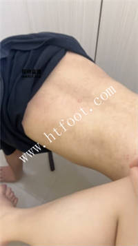 100852pvrzcaxanaaxavab.jpg