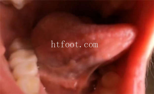 083437payhg9ncdn6cd3v9.jpg