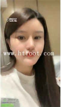 TL17675 南京惠子S吃东西呕吐给G吃21分钟