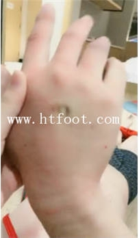 TL14692 诺曦依艺yapoo式史上最狠第二弹打成猪头圣水消毒91分钟