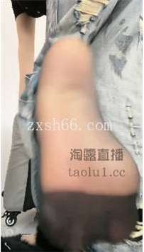 TL198 薯条S 第一视角黑+肉