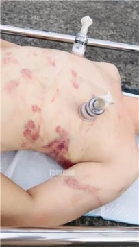 【调教视频】【黛樱】户外阳台重刑调-螃蟹夹乳 bf56757